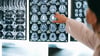  A Diagnostic Radiologist Pointing To Brain Scans