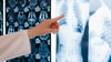 A Radiologist Reviewing Chest X-Rays