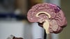 Brain Model