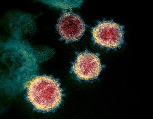 An image of the novel coronavirus, SARS-CoV-2, under a microscope