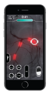 A phone displaying one of Level Ex's medical gaming products