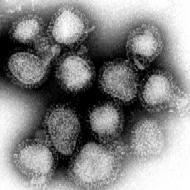 The influenza viruses that caused the Hong Kong flu (magnified approximately 100,000 times)