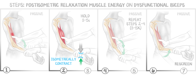 An illustration from Osteopathic Medicine: A Core Concepts Approach shows the technique for using postisometric relaxation muscle energy on dysfunctional biceps.