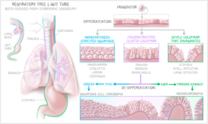A medical illustration by Lisa Clark depicting epithelial relationships and disease