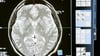 Brain scan image