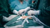 Surgeons Operating On A Patient