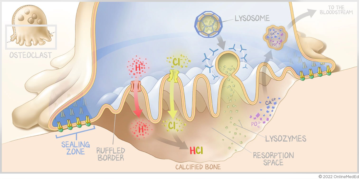 A medical illustration of an osteoclast